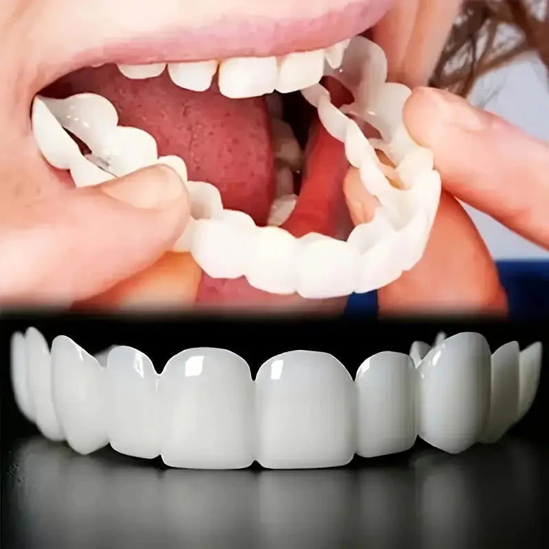 Snap on Smile Teeth Whitening veneers